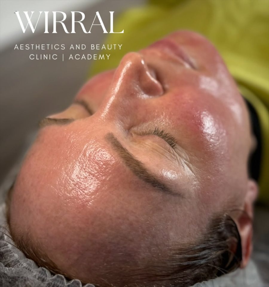 A client during a facial treatment at CK Beauty and Aesthetics in Heswall